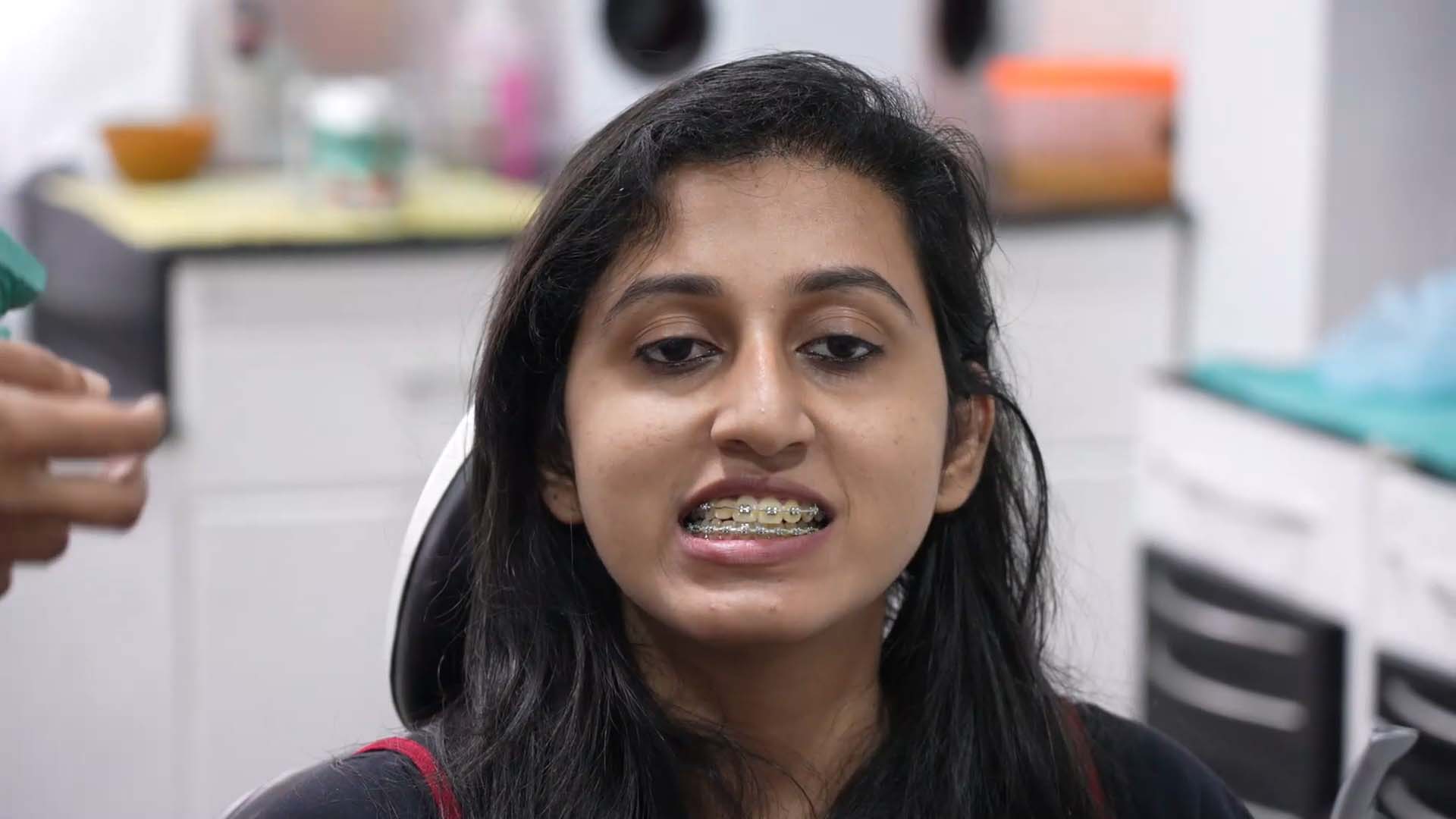 Bijaw surgery for long face patient